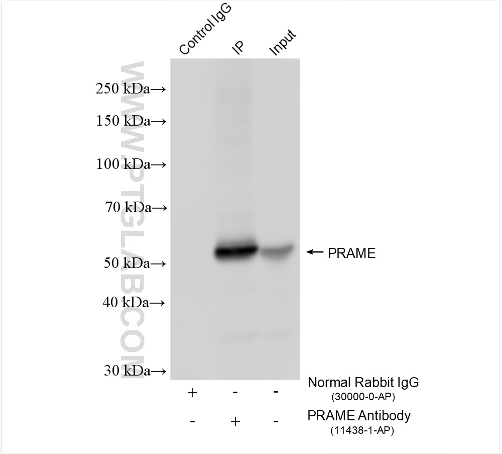 Immunoprecipitation (IP) experiment of K-562 cells using PRAME Polyclonal antibody (11438-1-AP)