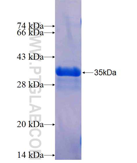 PRB1 fusion protein Ag26363 SDS-PAGE