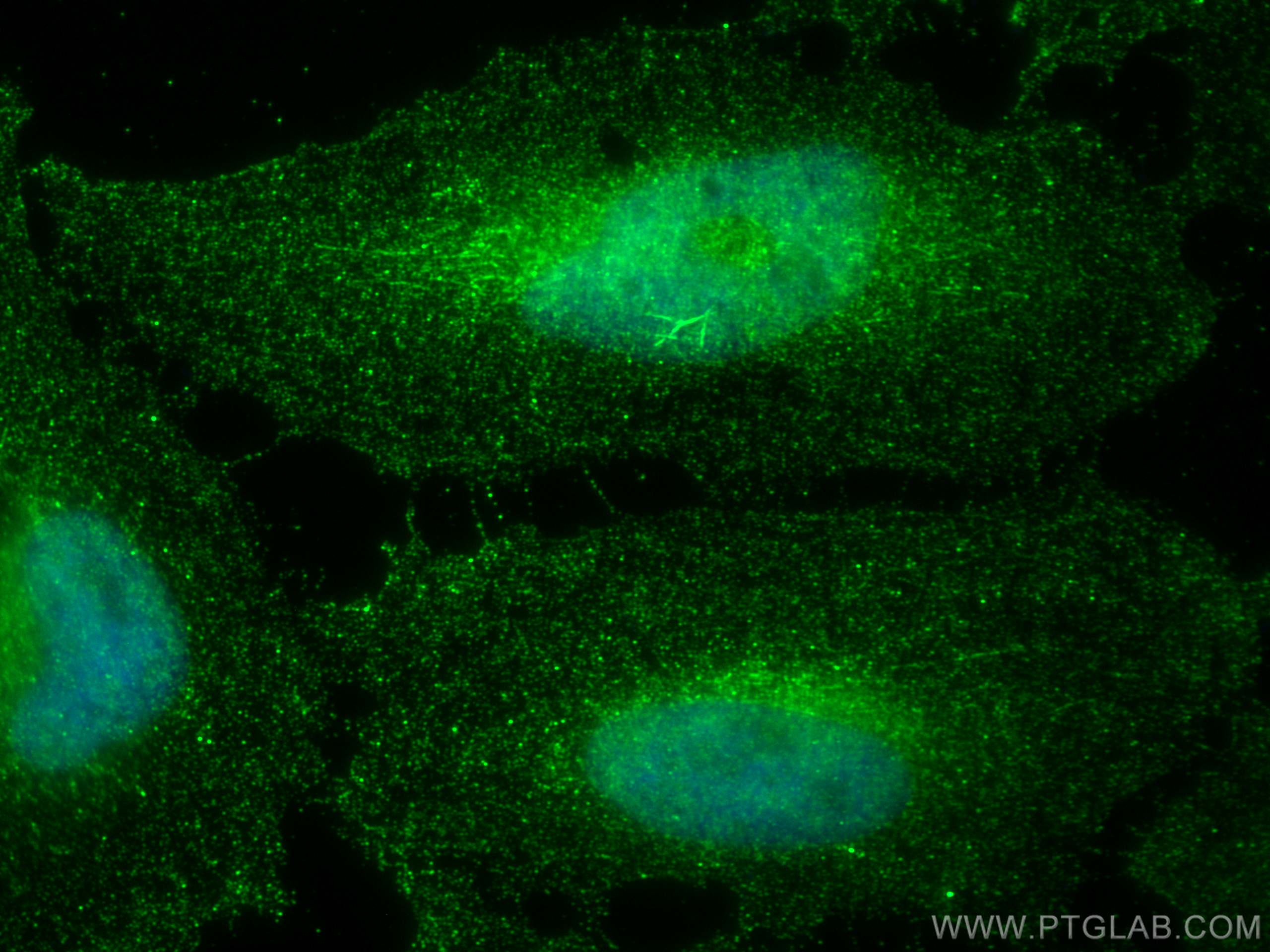 Immunofluorescence (IF) / fluorescent staining of HeLa cells using PRC1 Monoclonal antibody (67027-1-Ig)