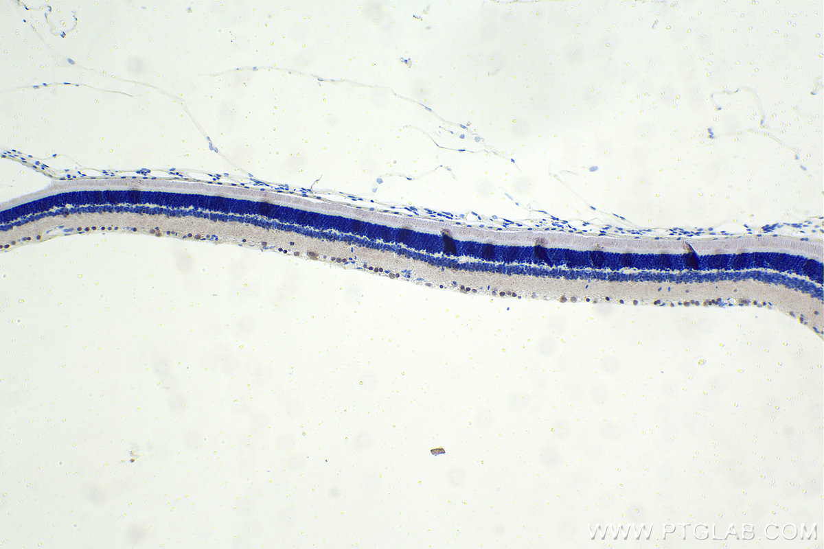 Immunohistochemistry (IHC) staining of rat eye tissue using PRDM13 Polyclonal antibody (30453-1-AP)