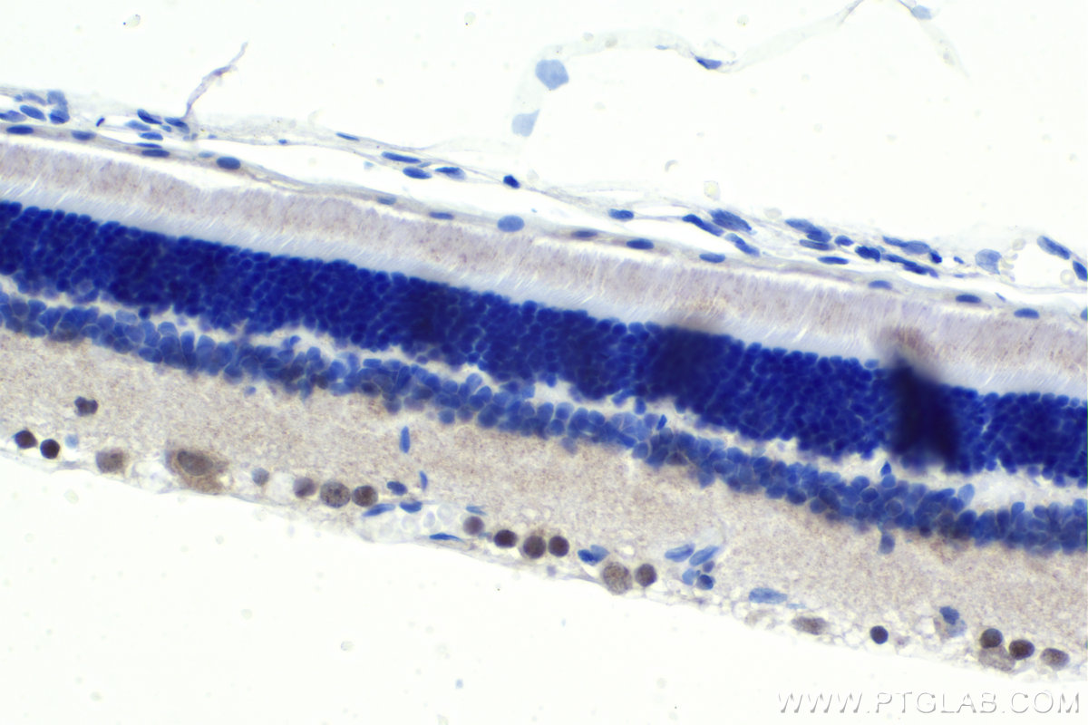 Immunohistochemistry (IHC) staining of rat eye tissue using PRDM13 Polyclonal antibody (30453-1-AP)