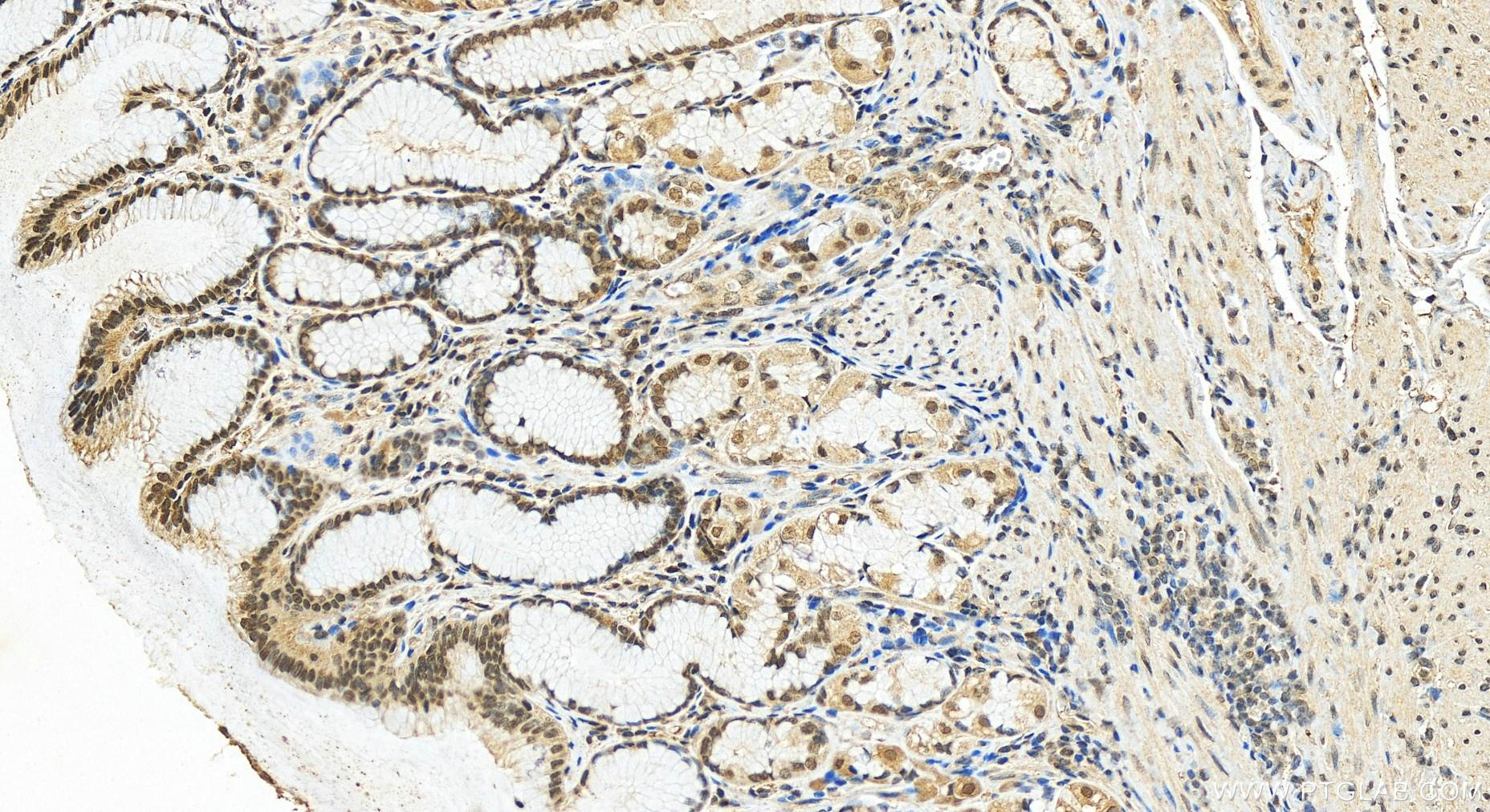 Immunohistochemistry (IHC) staining of human stomach tissue using PRDM16 Polyclonal antibody (55361-1-AP)