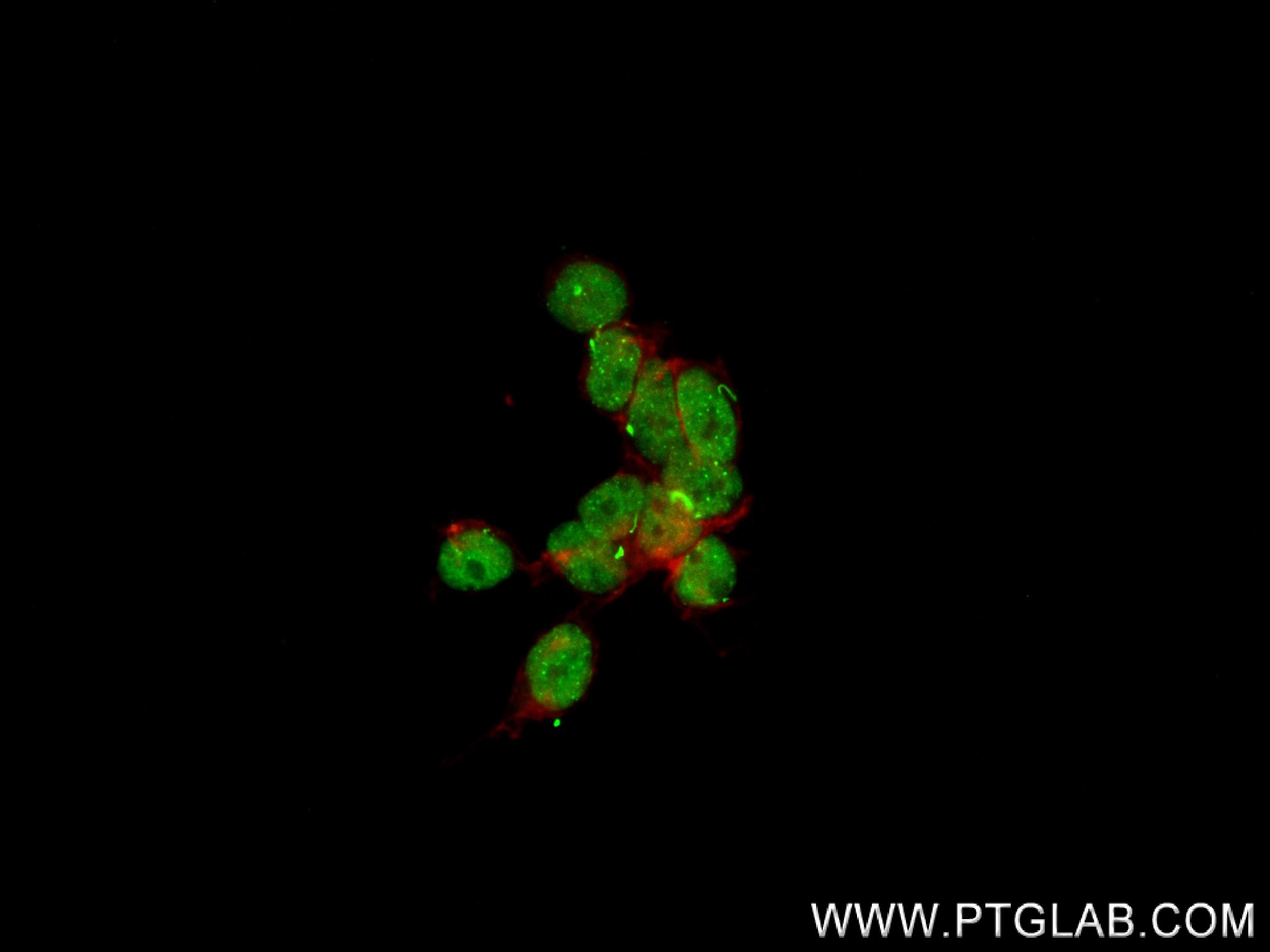 Immunofluorescence (IF) / fluorescent staining of HEK-293 cells using PRDM16 Recombinant antibody (83872-1-RR)