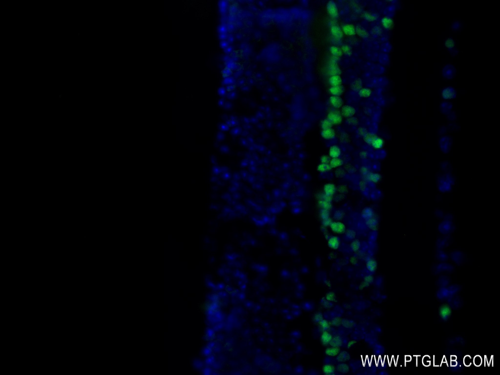 Immunofluorescence (IF) / fluorescent staining of mouse eye tissue using PRDM8 Recombinant antibody (84716-2-RR)