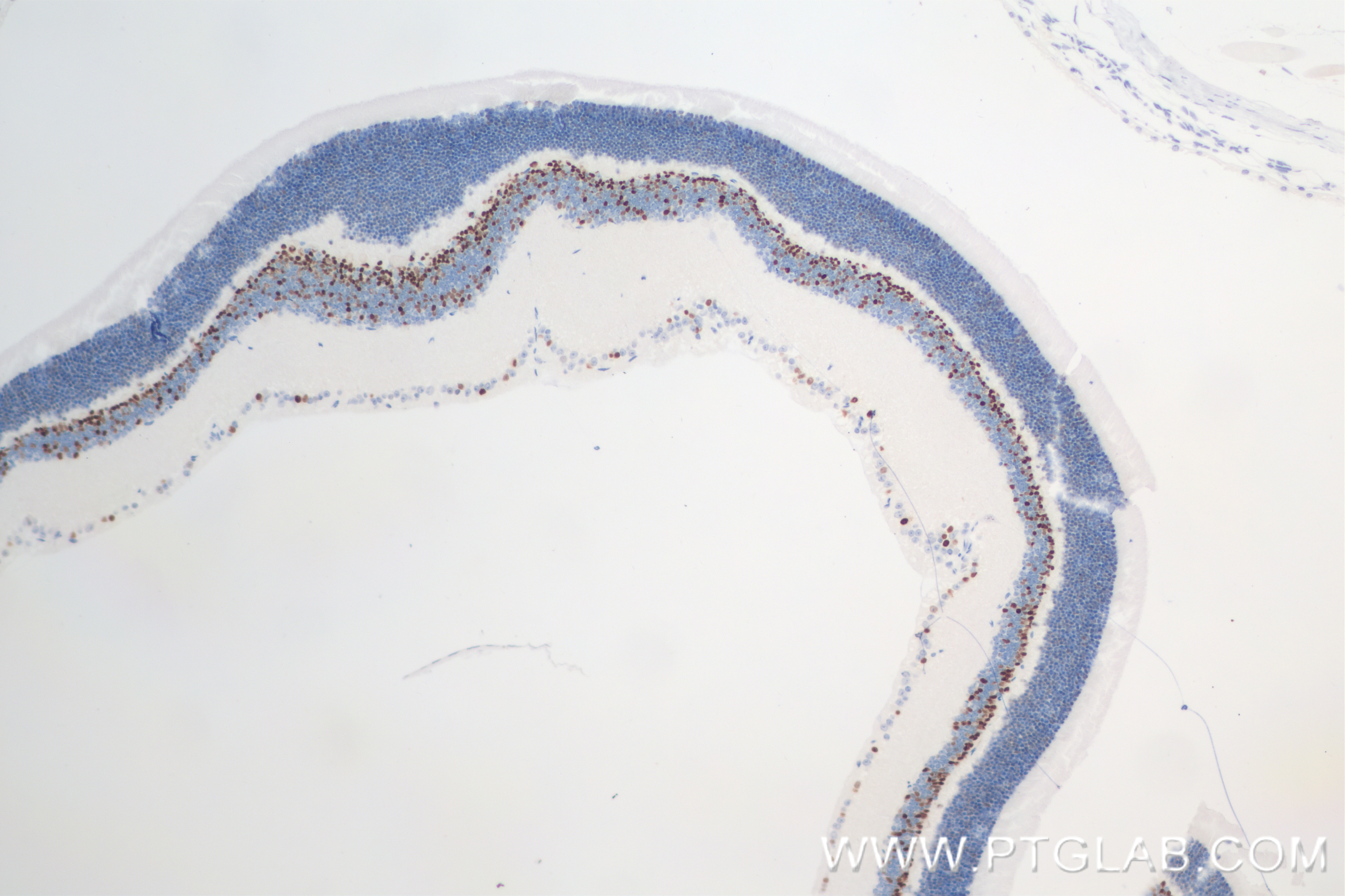 Immunohistochemistry (IHC) staining of mouse eye tissue using PRDM8 Recombinant antibody (84716-2-RR)