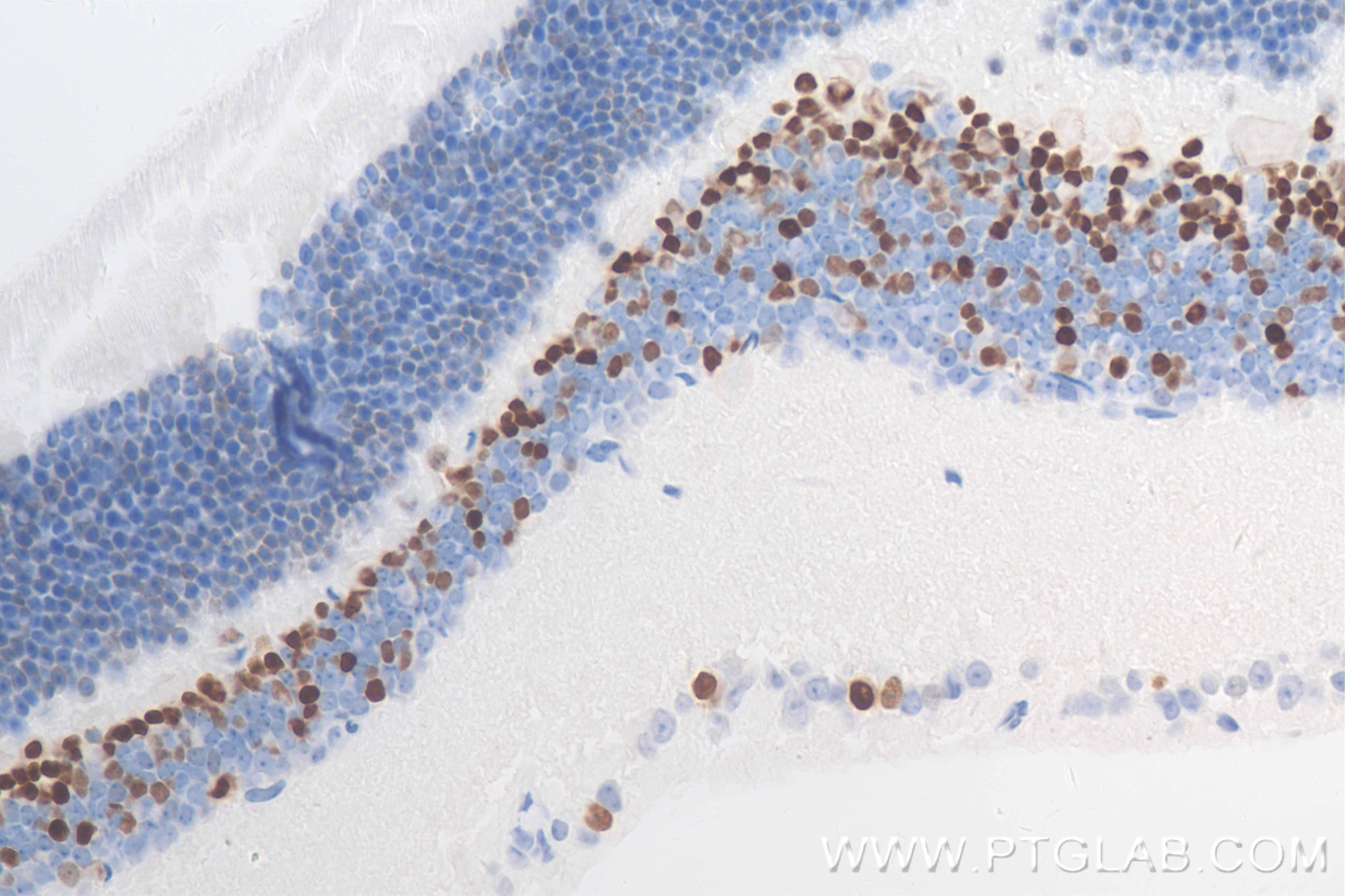 Immunohistochemistry (IHC) staining of mouse eye tissue using PRDM8 Recombinant antibody (84716-2-RR)