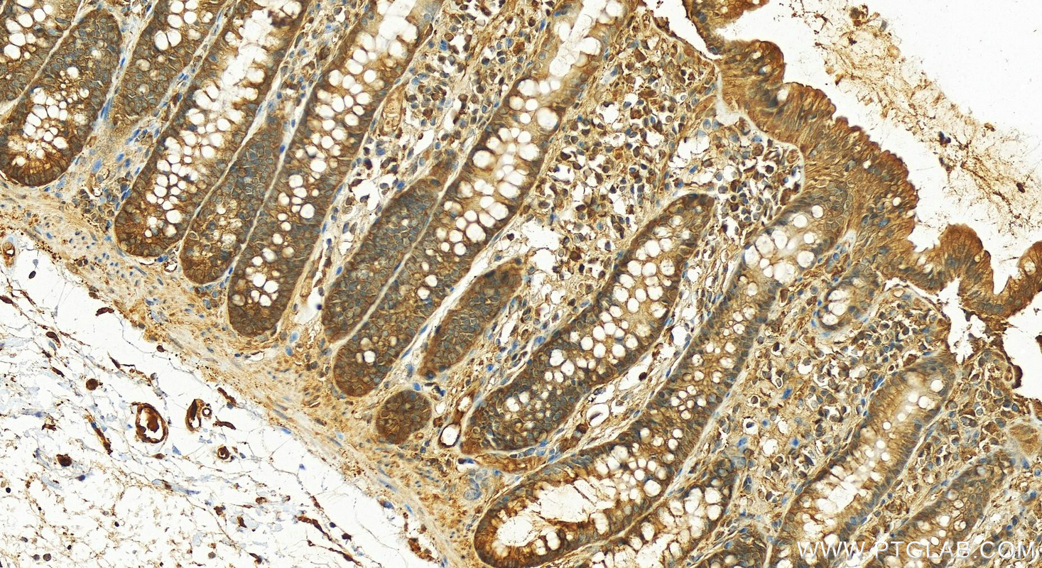 Immunohistochemistry (IHC) staining of human colon tissue using PRDX1 Polyclonal antibody (15816-1-AP)