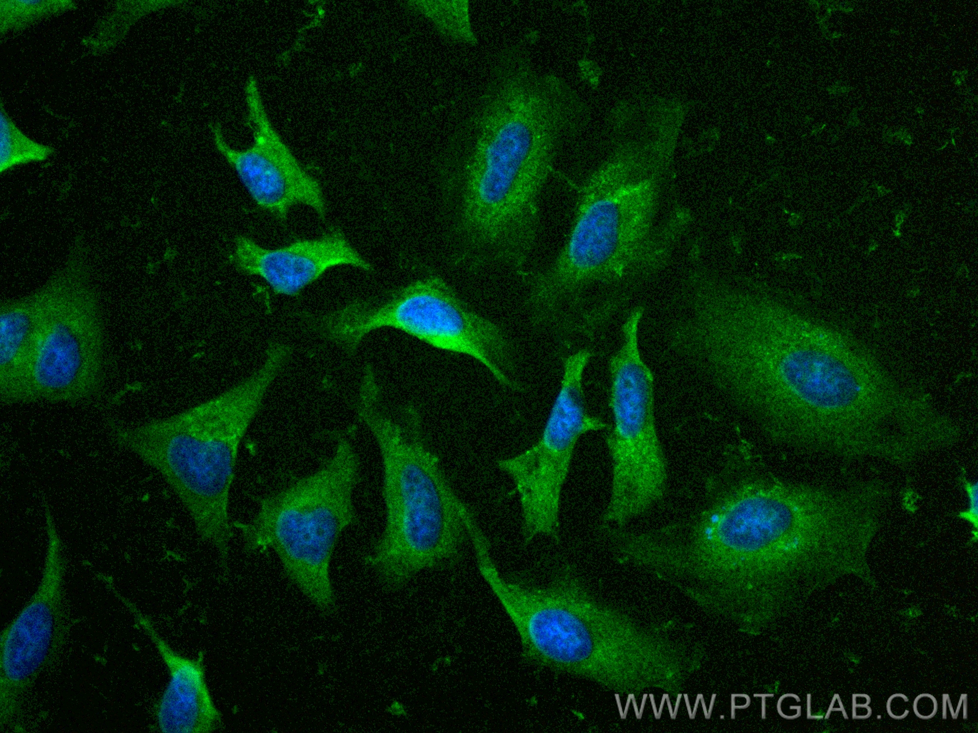 Immunofluorescence (IF) / fluorescent staining of HeLa cells using CoraLite® Plus 488-conjugated PRDX1 Polyclonal ant (CL488-20568)