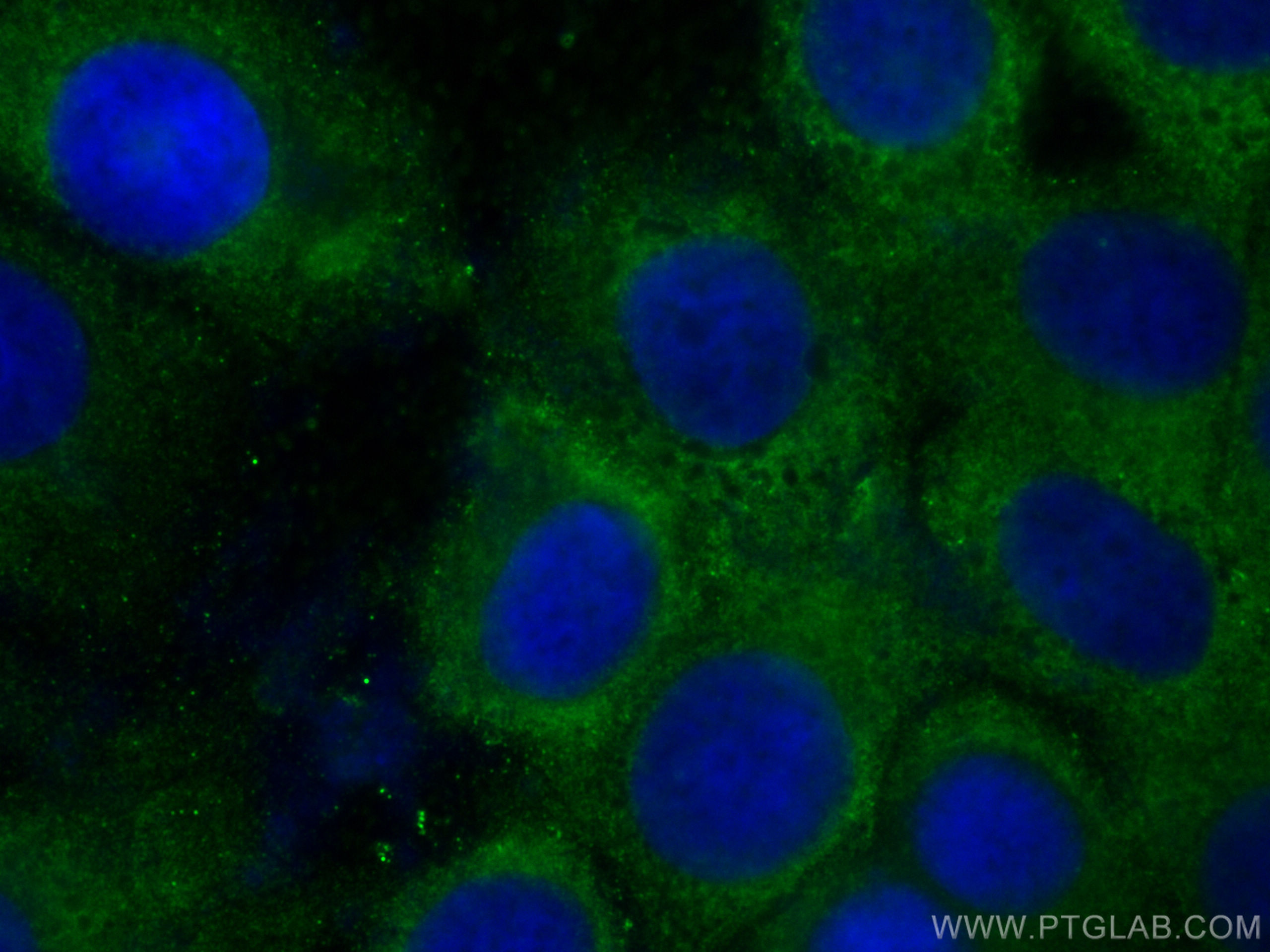 Immunofluorescence (IF) / fluorescent staining of MCF-7 cells using peroxiredoxin 2 Monoclonal antibody (60202-1-Ig)