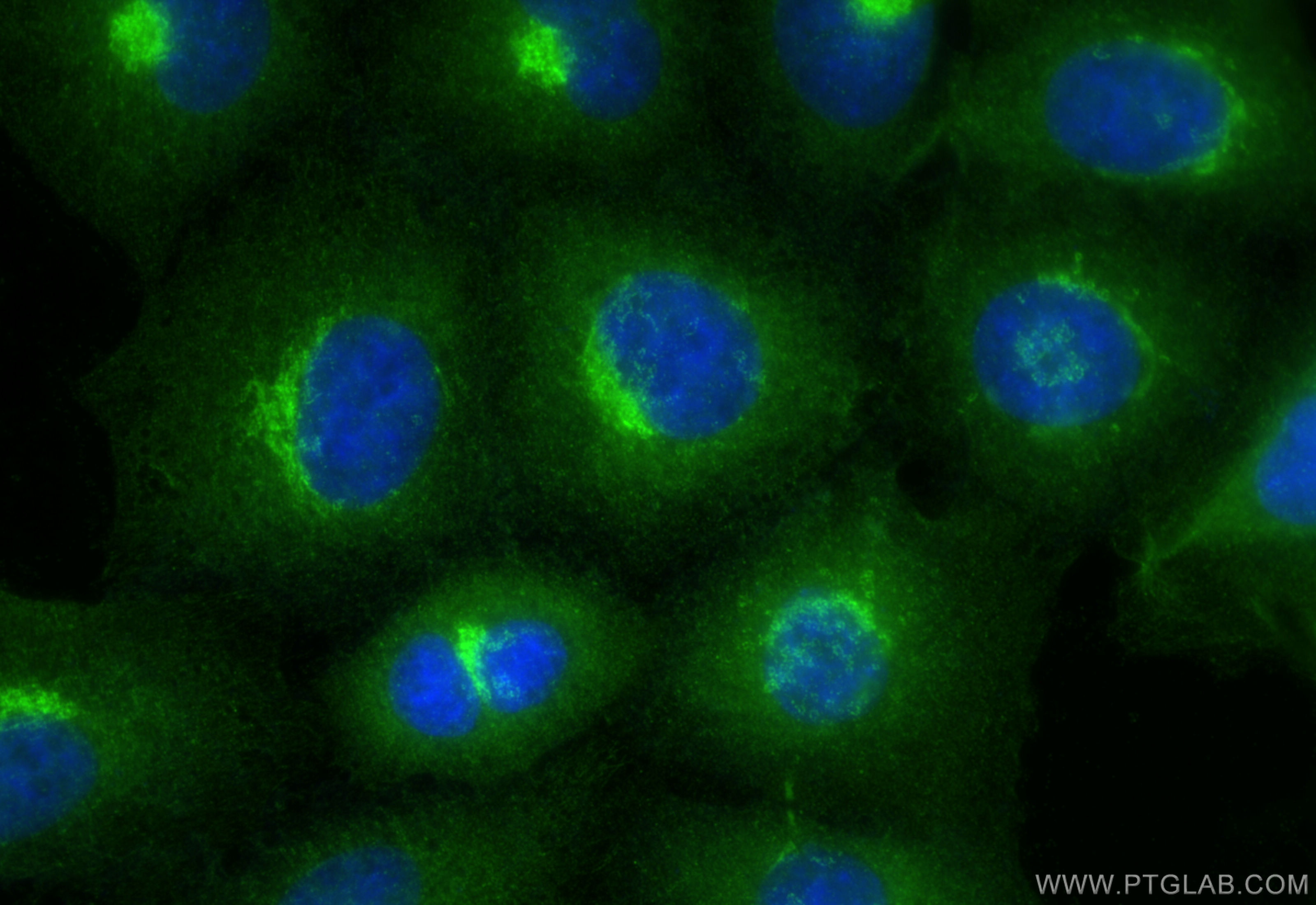 Immunofluorescence (IF) / fluorescent staining of A549 cells using PRDX3 Polyclonal antibody (55087-1-AP)