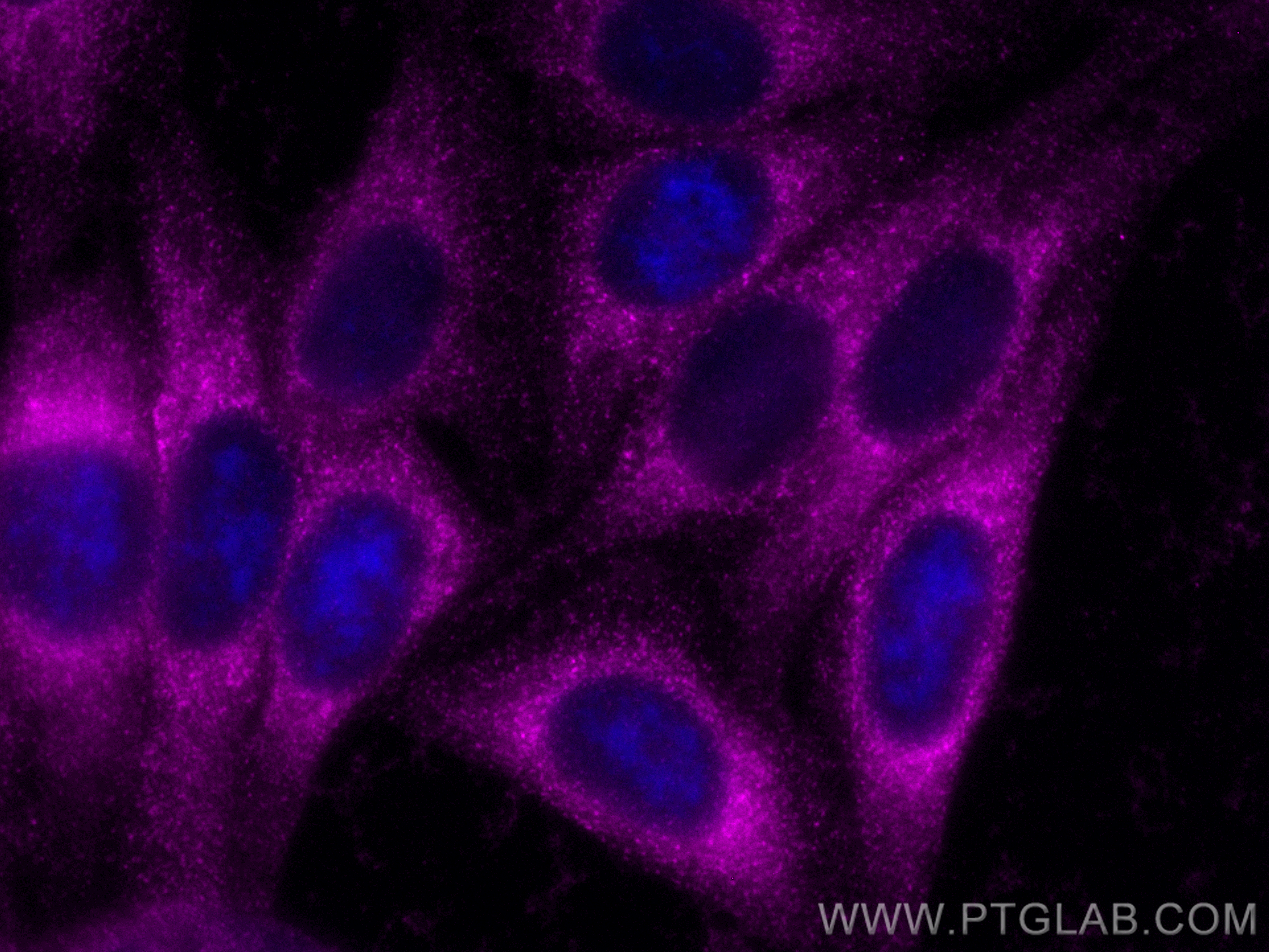 Immunofluorescence (IF) / fluorescent staining of HepG2 cells using CoraLite® Plus 647-conjugated PRDX4 Polyclonal ant (CL647-10703)