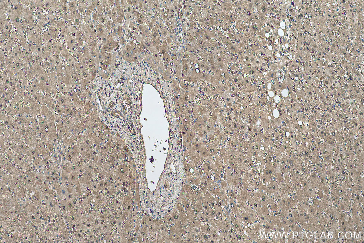 Immunohistochemistry (IHC) staining of human liver tissue using PRDX6 Polyclonal antibody (13585-1-AP)