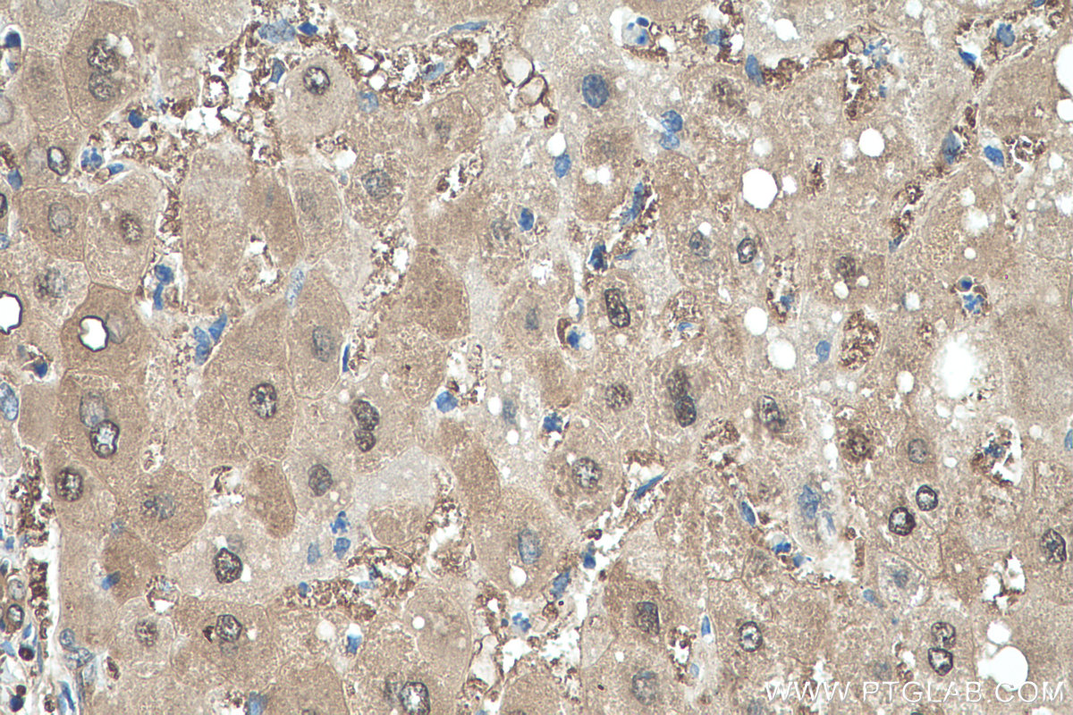 Immunohistochemistry (IHC) staining of human liver tissue using PRDX6 Polyclonal antibody (13585-1-AP)