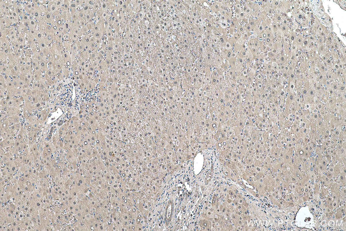 Immunohistochemistry (IHC) staining of human liver tissue using PRDX6 Monoclonal antibody (67499-1-Ig)