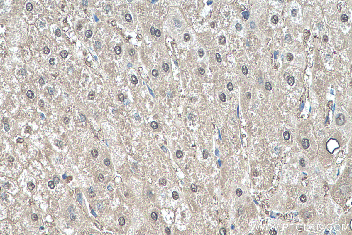 Immunohistochemistry (IHC) staining of human liver tissue using PRDX6 Monoclonal antibody (67499-1-Ig)