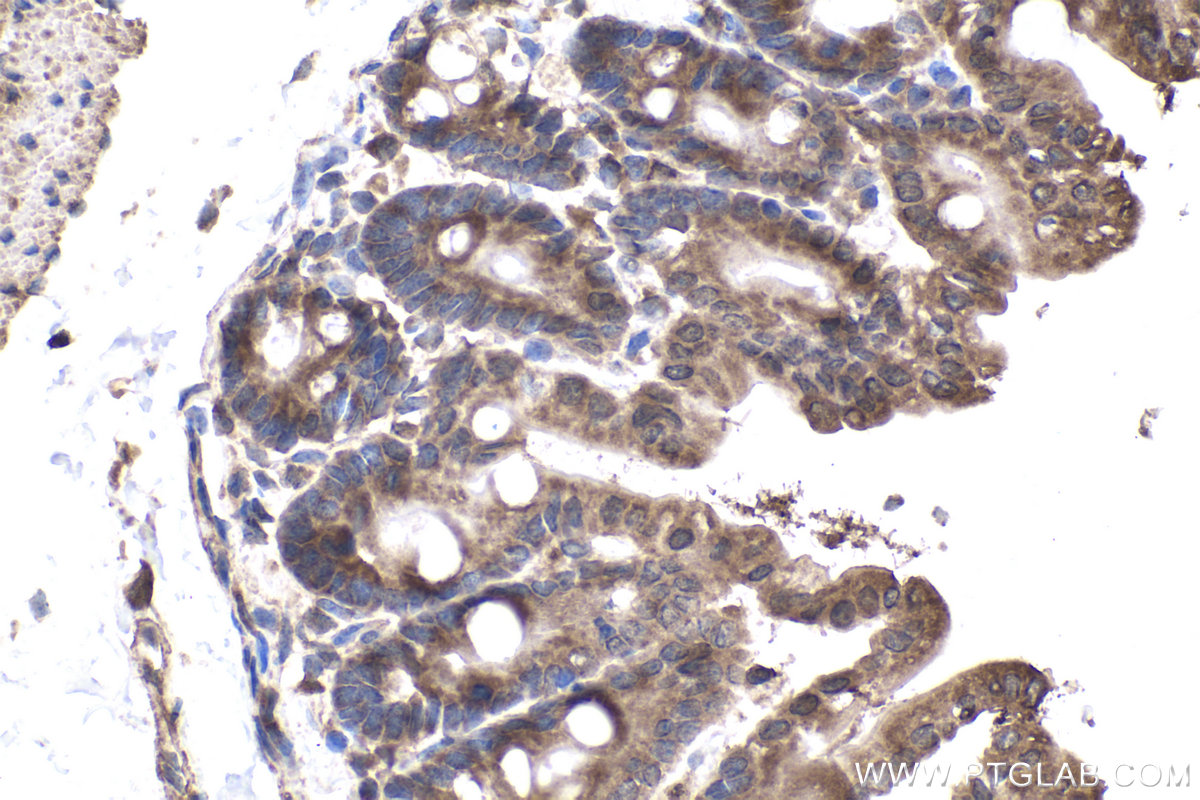 Immunohistochemistry (IHC) staining of mouse intestine using PREB Polyclonal antibody (10146-2-AP)