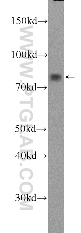 Western Blot (WB) analysis of K-562 cells using LPPR3 Polyclonal antibody (25936-1-AP)