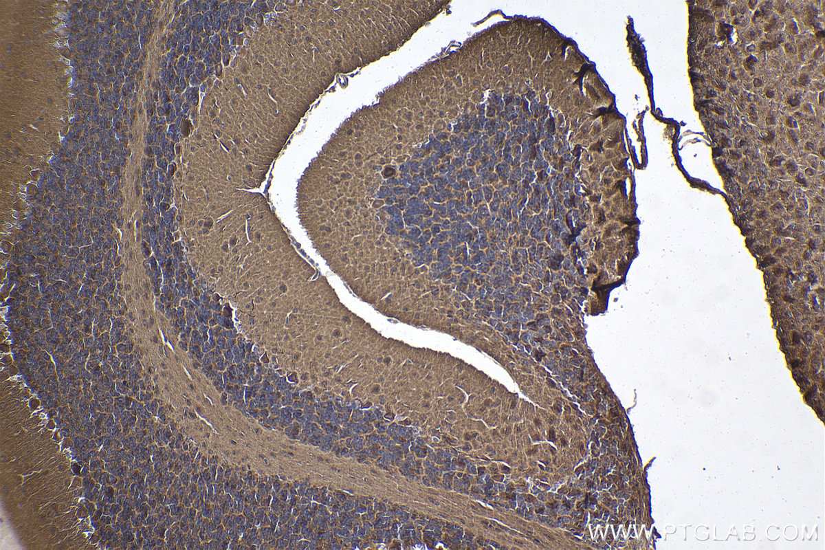 Immunohistochemistry (IHC) staining of mouse cerebellum tissue using PRICKLE1 Polyclonal antibody (22589-1-AP)