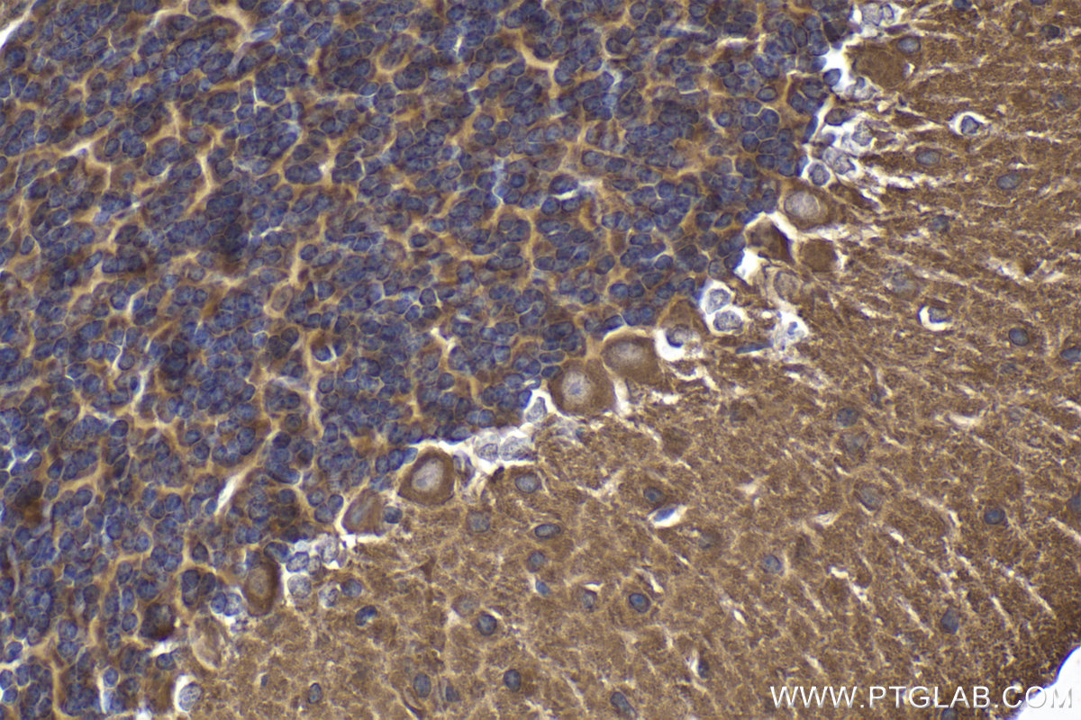 Immunohistochemistry (IHC) staining of mouse cerebellum tissue using PRICKLE1 Polyclonal antibody (22589-1-AP)