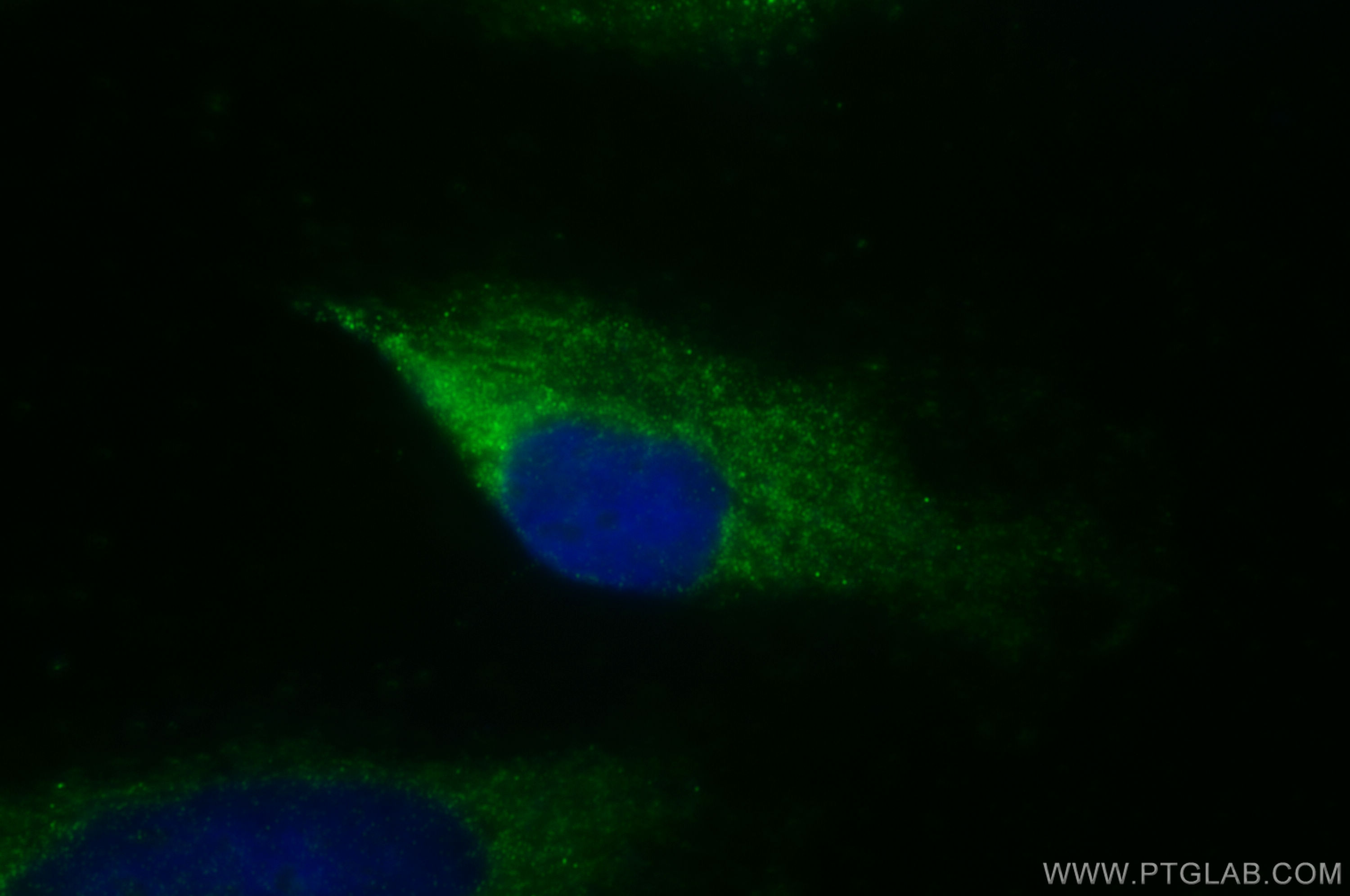Immunofluorescence (IF) / fluorescent staining of HeLa cells using AMPK Beta 1 Polyclonal antibody (10308-1-AP)