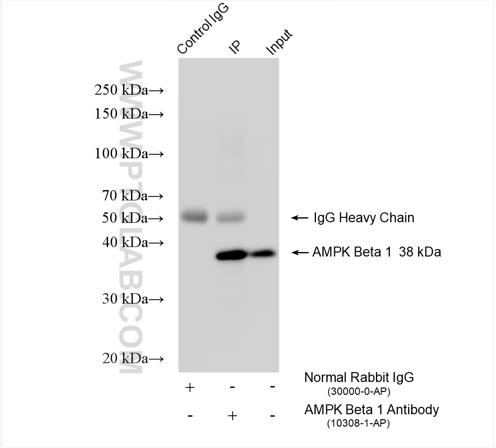 Immunoprecipitation (IP) experiment of mouse liver tissue using AMPK Beta 1 Polyclonal antibody (10308-1-AP)