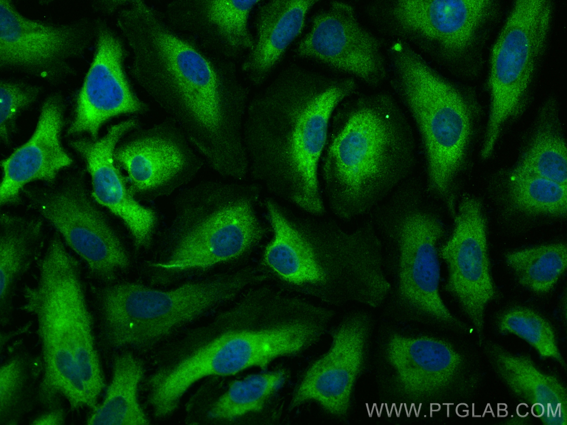 Immunofluorescence (IF) / fluorescent staining of HeLa cells using PRKAR1A Polyclonal antibody (20358-1-AP)