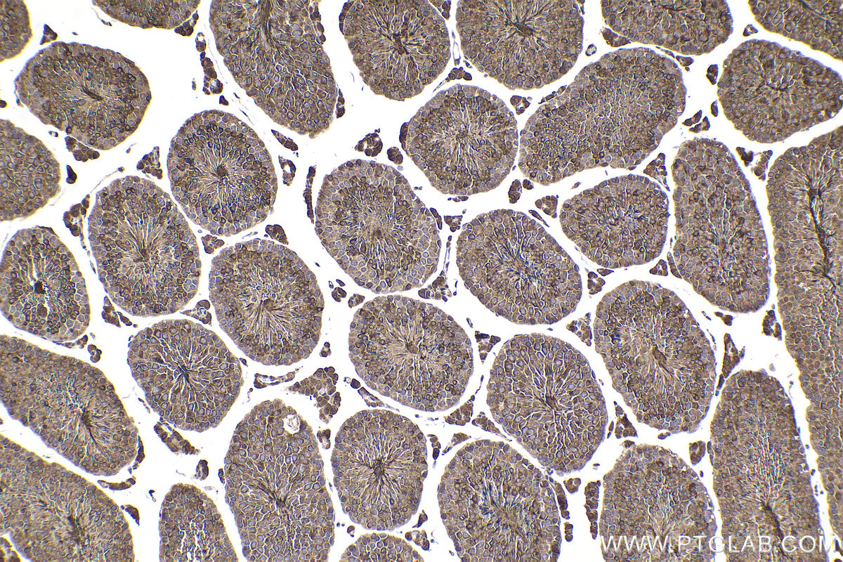 Immunohistochemistry (IHC) staining of mouse testis tissue using PRKAR1A Polyclonal antibody (20358-1-AP)