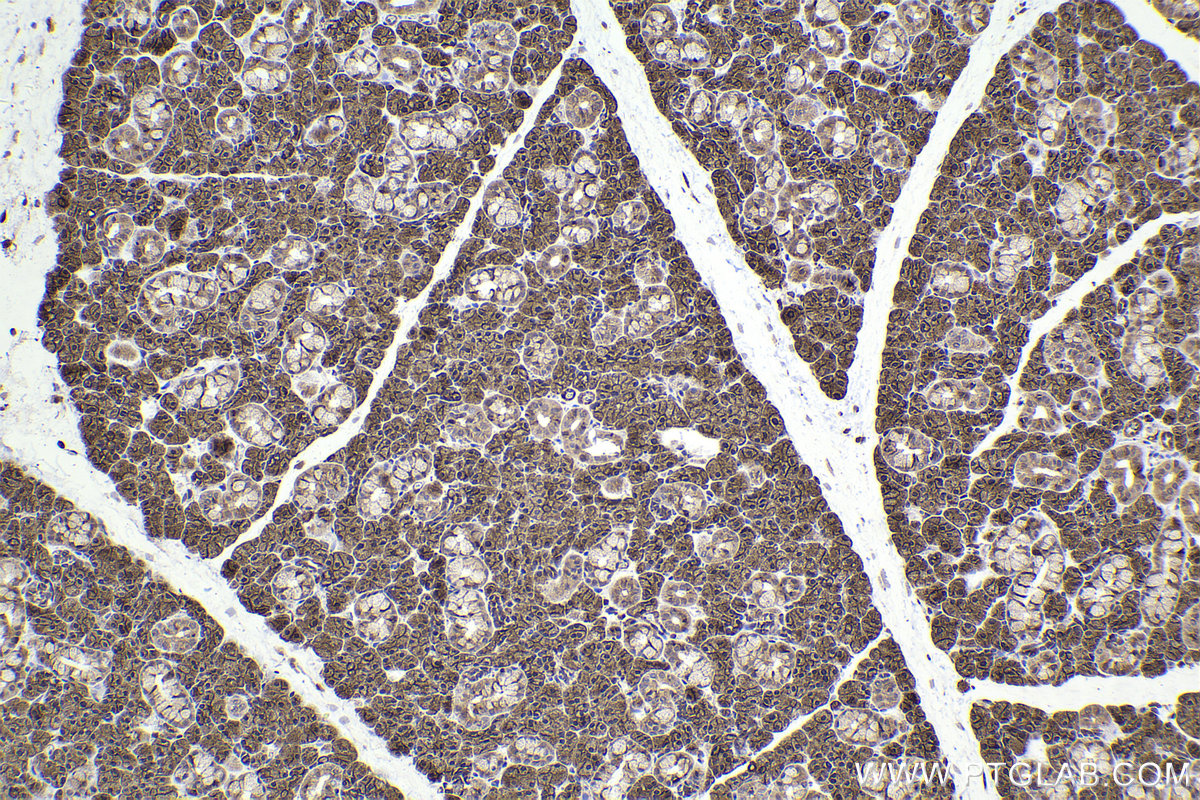 Immunohistochemistry (IHC) staining of rat salivary gland tissue using PRKAR1A Polyclonal antibody (20358-1-AP)