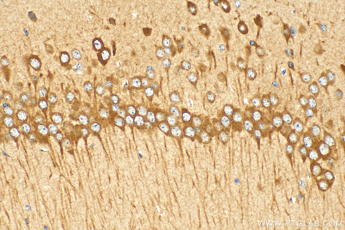 Immunohistochemistry (IHC) staining of mouse brain tissue using PRKAR1A Polyclonal antibody (20358-1-AP)