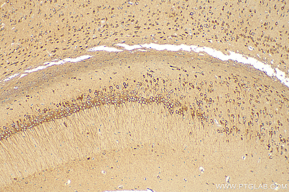 Immunohistochemistry (IHC) staining of mouse brain tissue using PRKAR1A Polyclonal antibody (20358-1-AP)