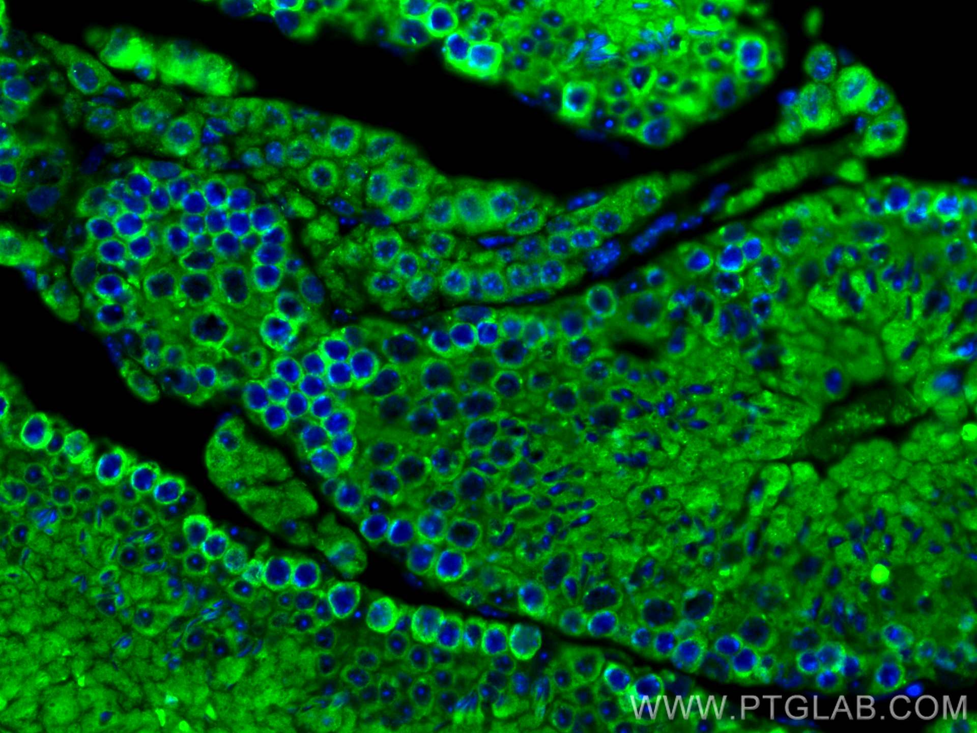 Immunofluorescence (IF) / fluorescent staining of mouse testis tissue using PRKAR2A Polyclonal antibody (10142-2-AP)