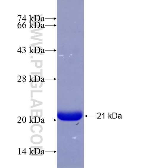 PRKAR2B fusion protein Ag28798 SDS-PAGE