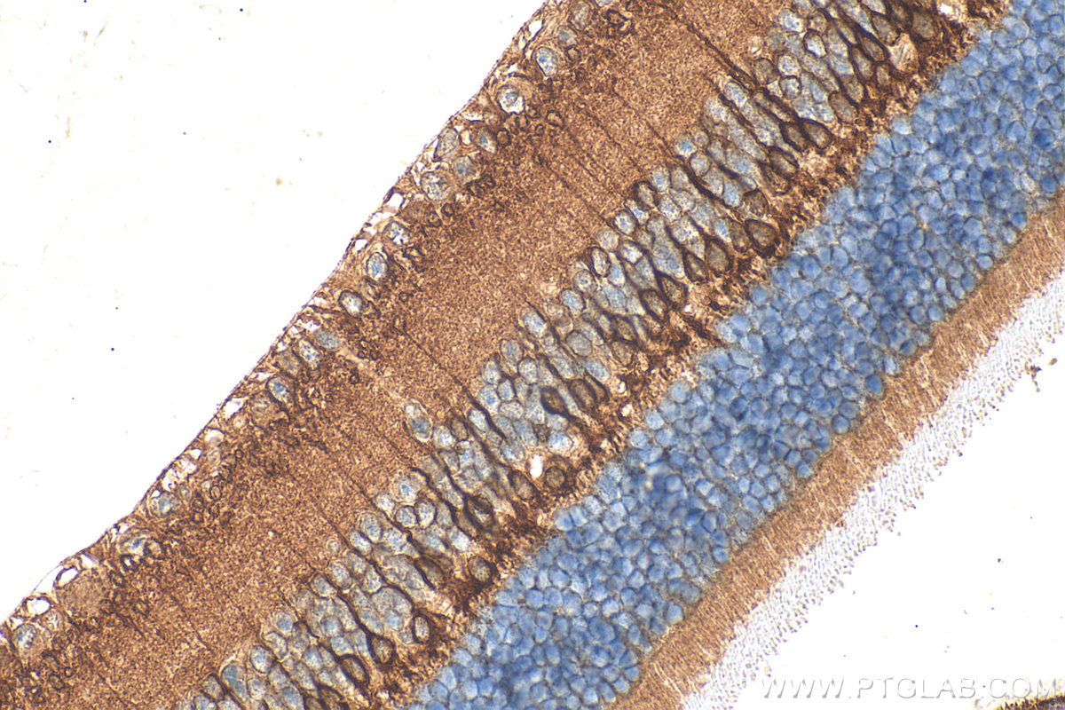 Immunohistochemistry (IHC) staining of mouse eye tissue using PKC Alpha Polyclonal antibody (21991-1-AP)