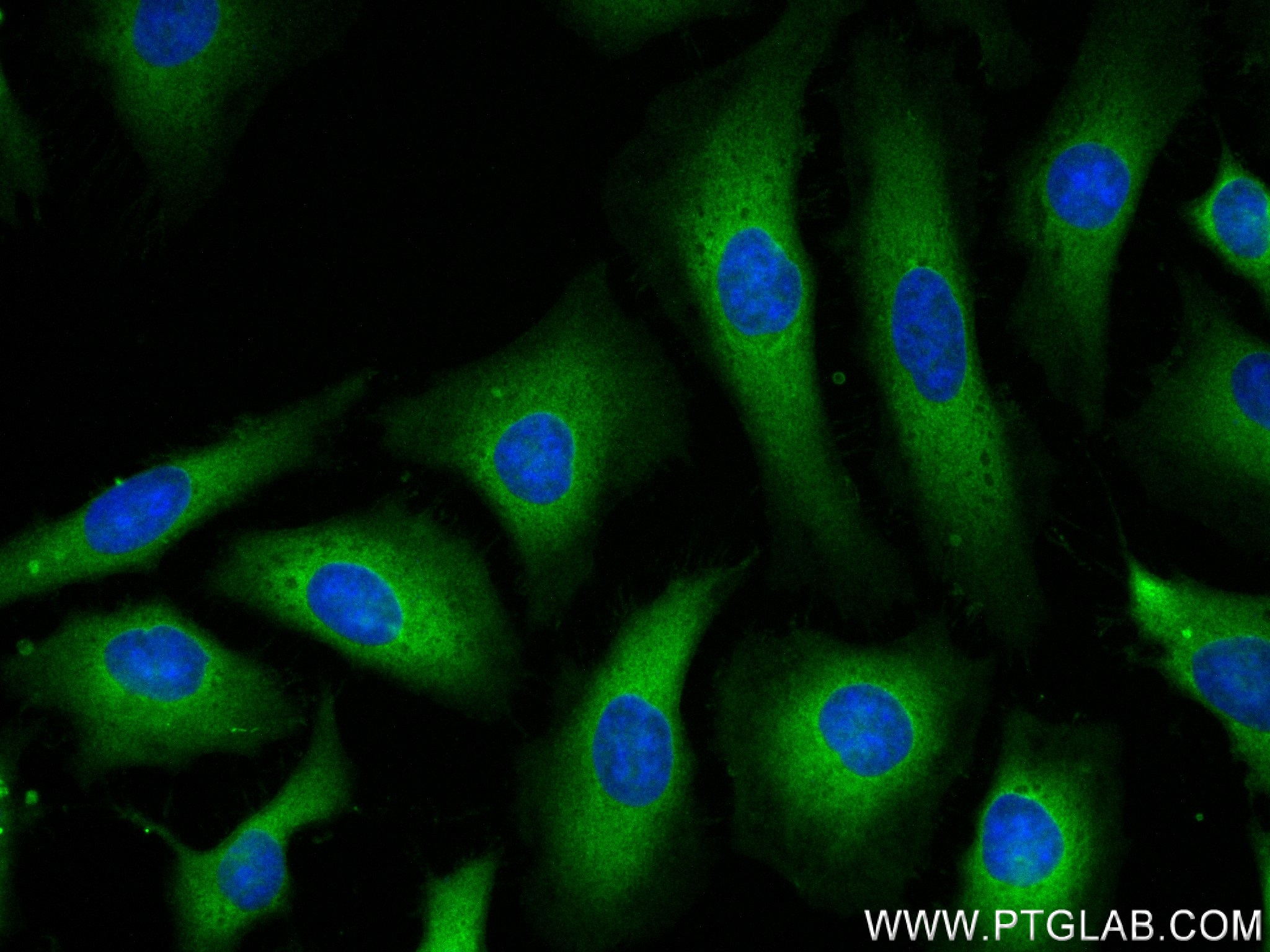 Immunofluorescence (IF) / fluorescent staining of HeLa cells using PKC Alpha Recombinant antibody (83840-6-RR)