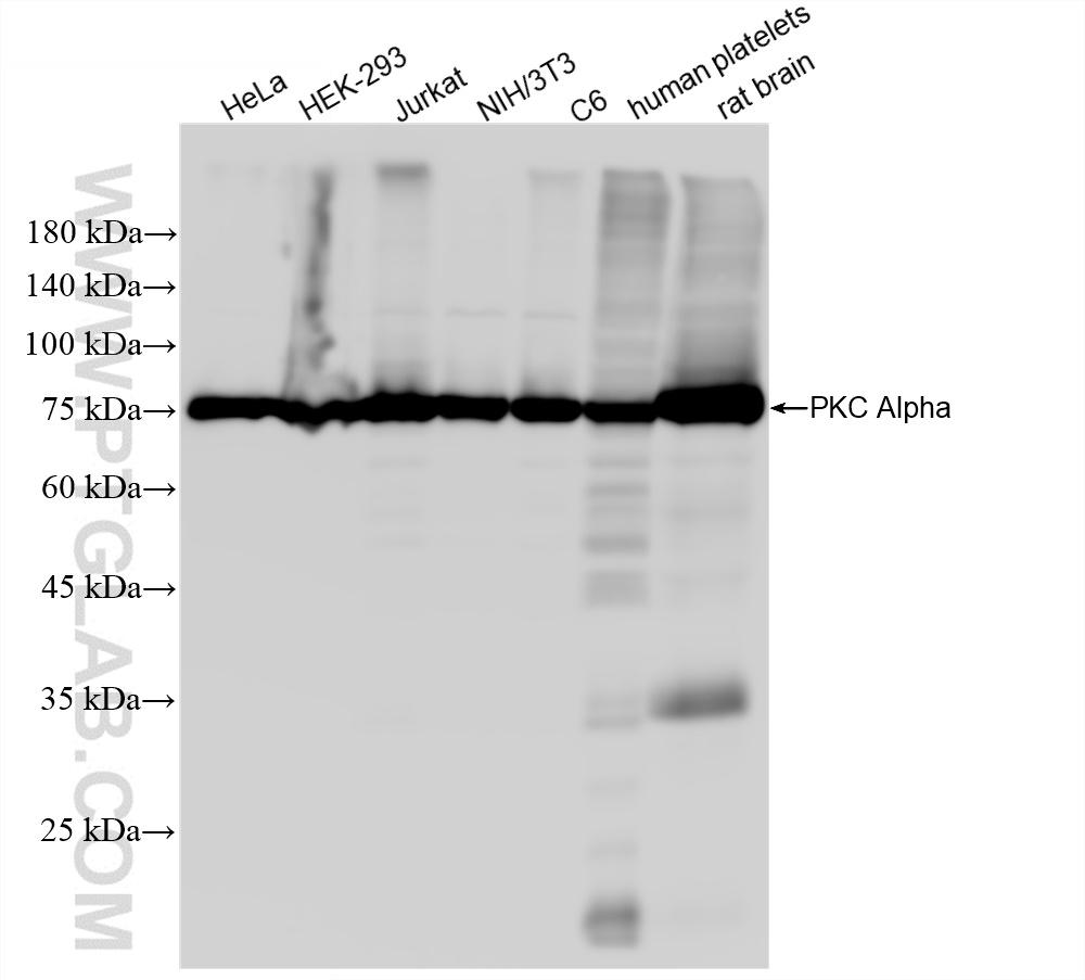 Western Blot (WB) analysis of various lysates using PKC Alpha Recombinant antibody (83840-6-RR)