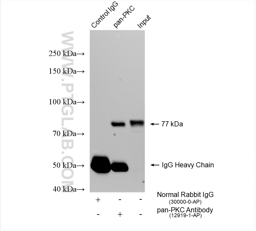 Immunoprecipitation (IP) experiment of mouse brain tissue using pan-PKC Polyclonal antibody (12919-1-AP)