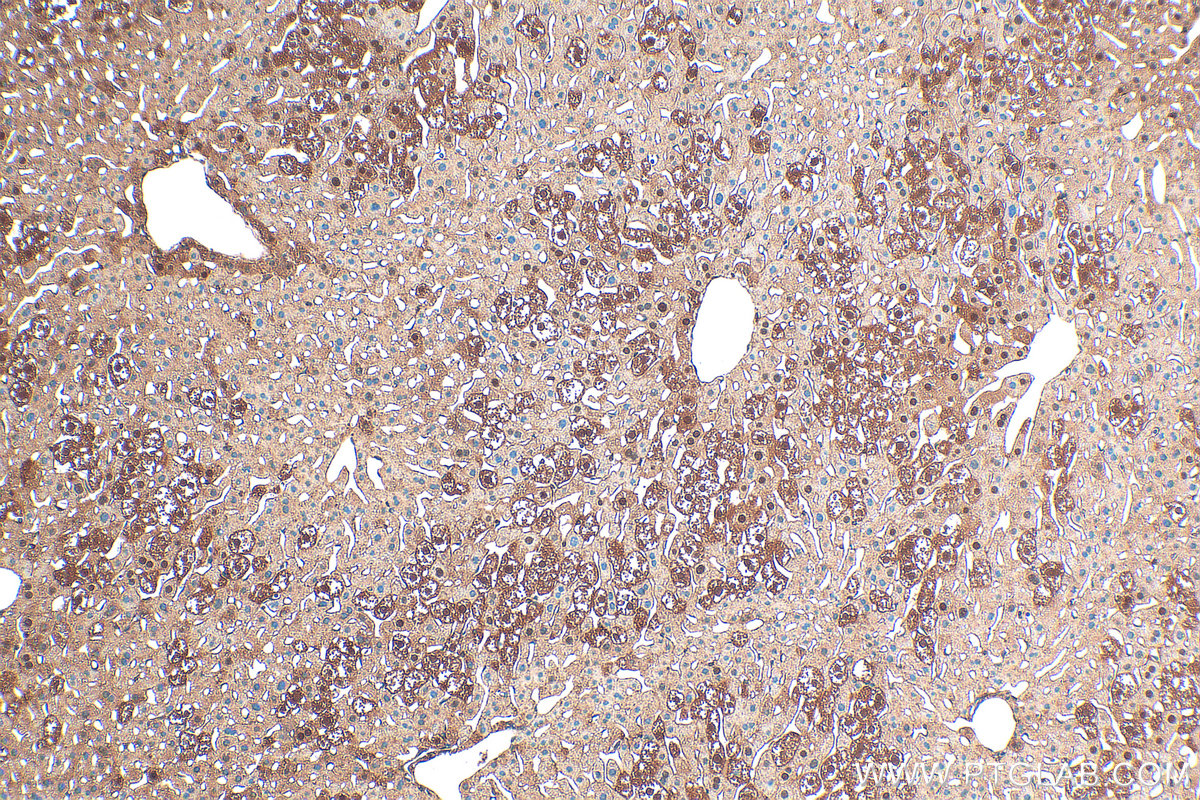 Immunohistochemistry (IHC) staining of mouse liver tissue using PKC Delta Polyclonal antibody (19132-1-AP)