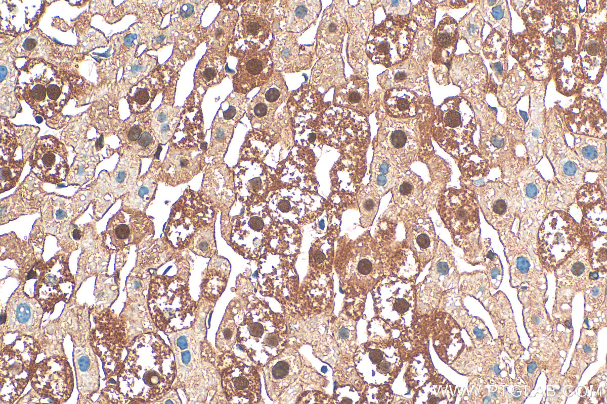 Immunohistochemistry (IHC) staining of mouse liver tissue using PKC Delta Polyclonal antibody (19132-1-AP)