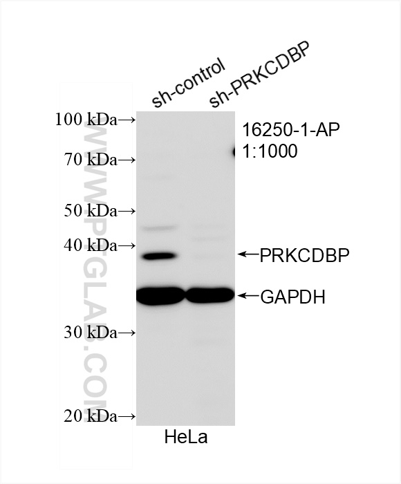 Western Blot (WB) analysis of HeLa cells using PRKCDBP Polyclonal antibody (16250-1-AP)