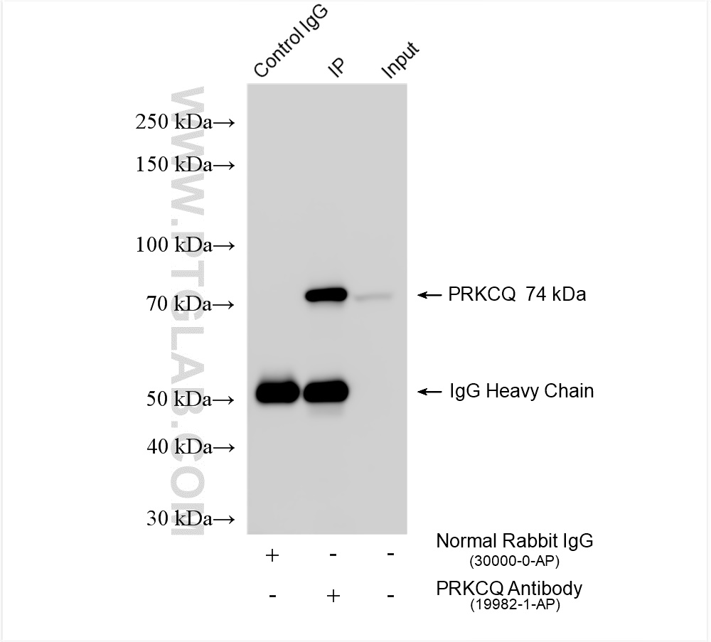 Immunoprecipitation (IP) experiment of K-562 cells using PRKCQ-Specific Polyclonal antibody (19982-1-AP)