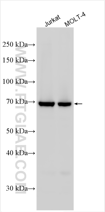 Western Blot (WB) analysis of various lysates using PRKCQ-Specific Polyclonal antibody (19982-1-AP)