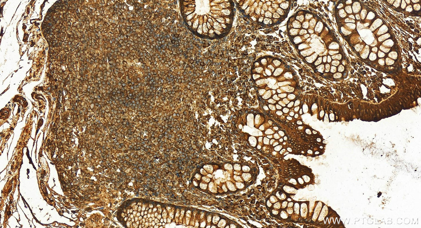 Immunohistochemistry (IHC) staining of human normal colon using PRKCSH Polyclonal antibody (12148-1-AP)