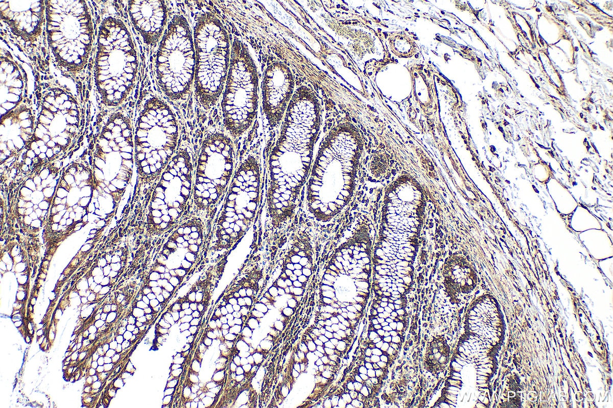 Immunohistochemistry (IHC) staining of human colon tissue using PRKCSH Polyclonal antibody (12148-1-AP)