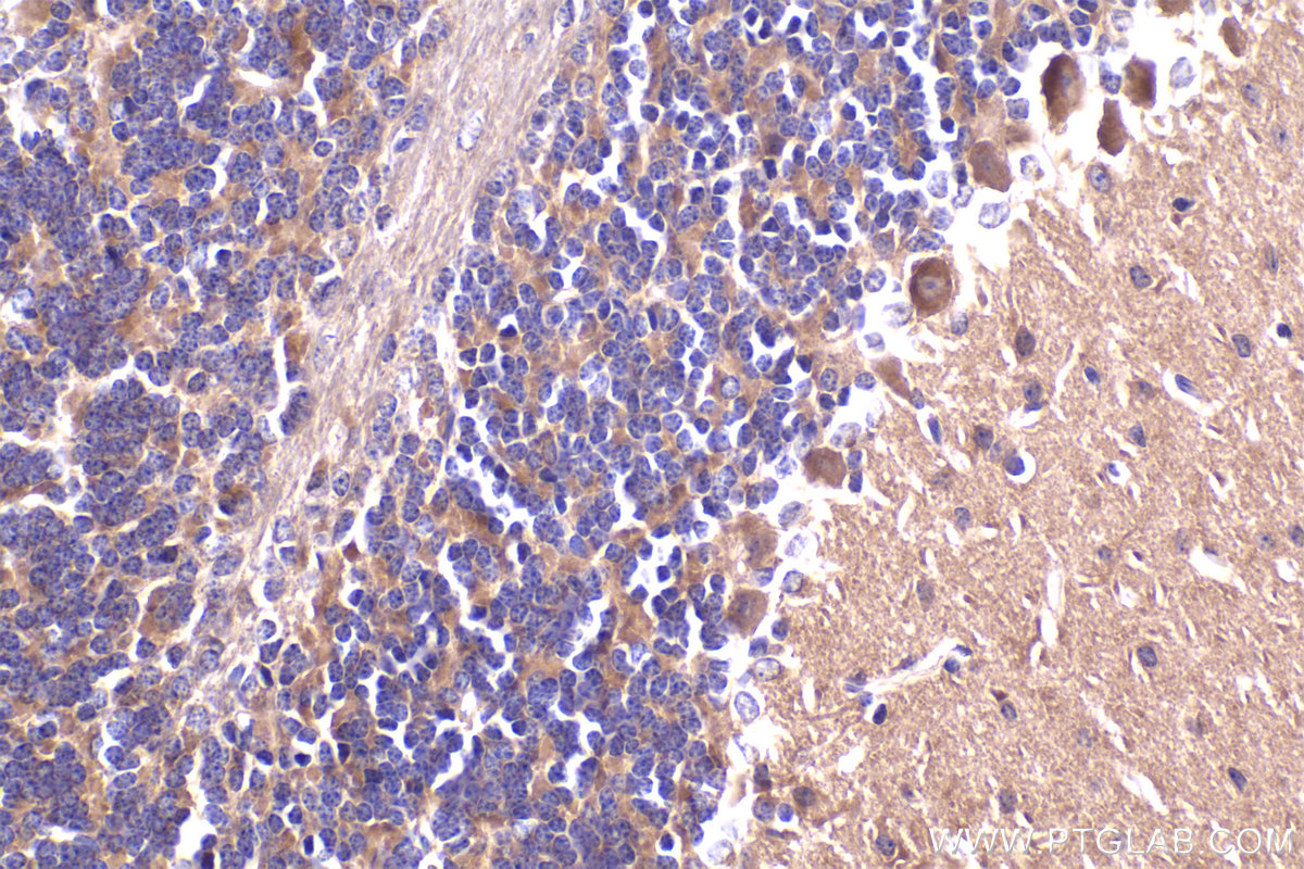 Immunohistochemistry (IHC) staining of mouse cerebellum tissue using PKC Zeta Polyclonal antibody (10860-1-AP)