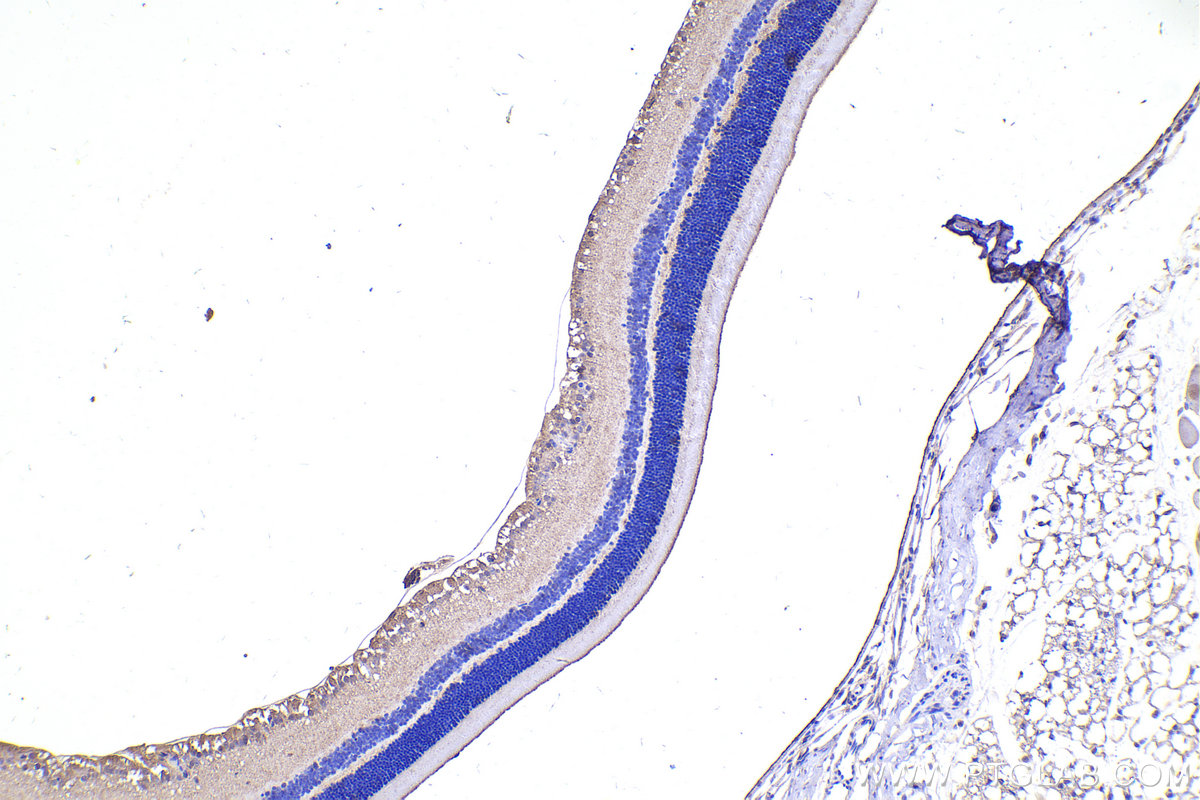 Immunohistochemistry (IHC) staining of mouse eye tissue using PKC Zeta Polyclonal antibody (10860-1-AP)