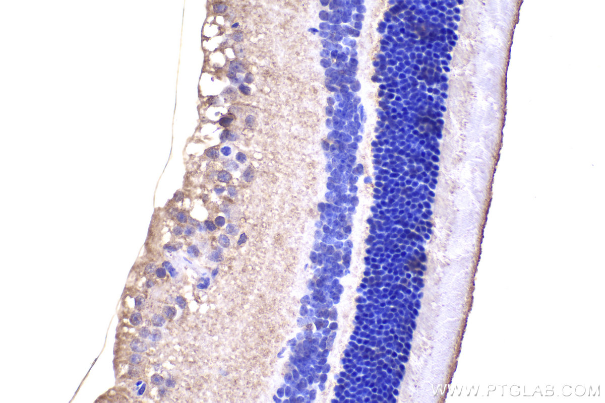 Immunohistochemistry (IHC) staining of mouse eye tissue using PKC Zeta Polyclonal antibody (10860-1-AP)