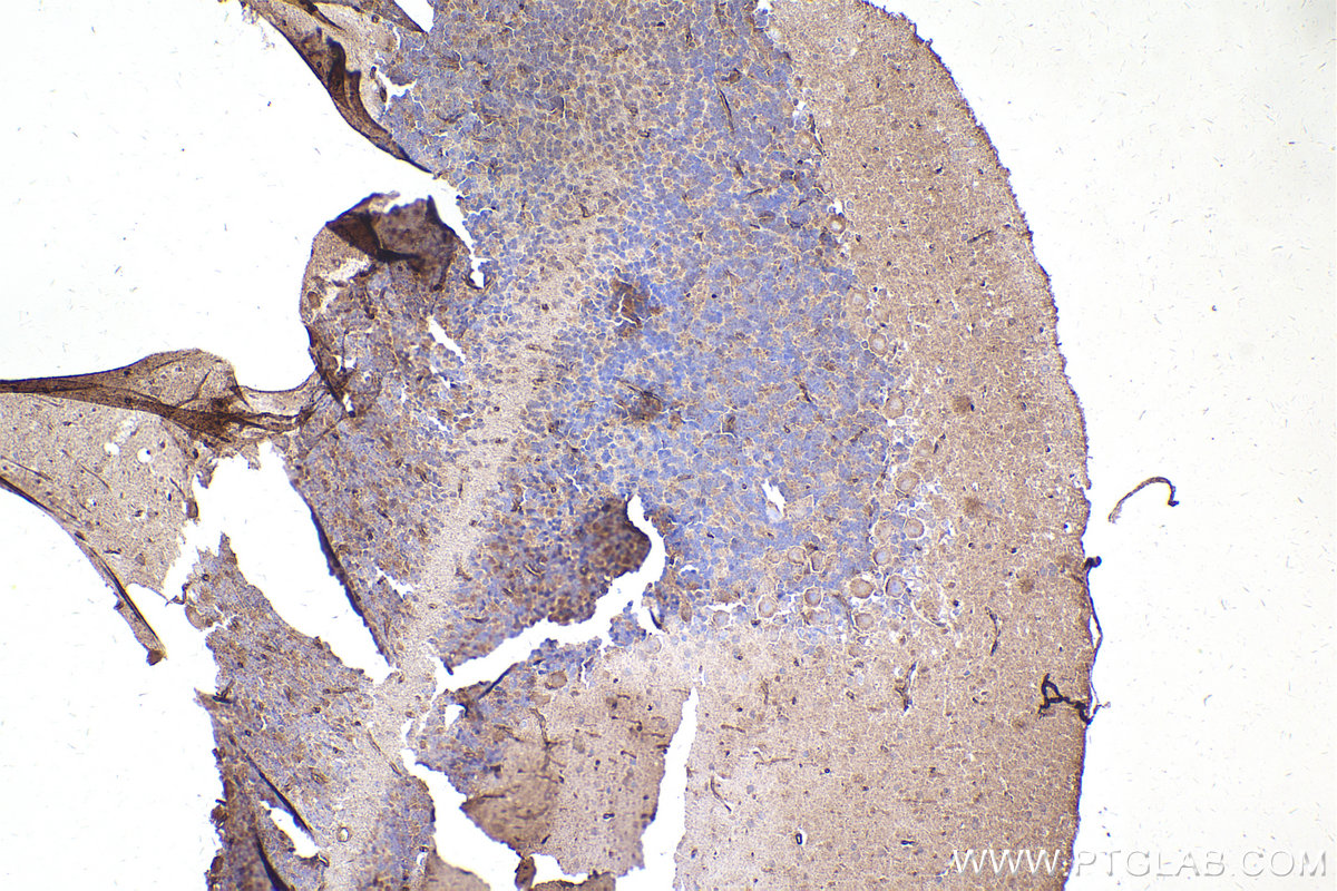 Immunohistochemistry (IHC) staining of rat cerebellum tissue using PRKD1 Polyclonal antibody (20714-1-AP)