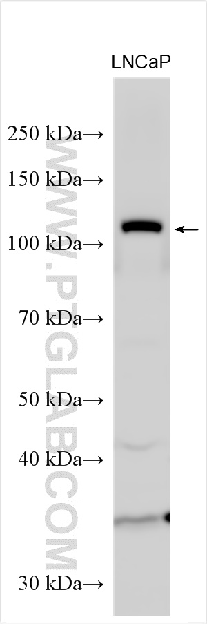 Western Blot (WB) analysis of LNCaP cells using PRKD1 Polyclonal antibody (20714-1-AP)