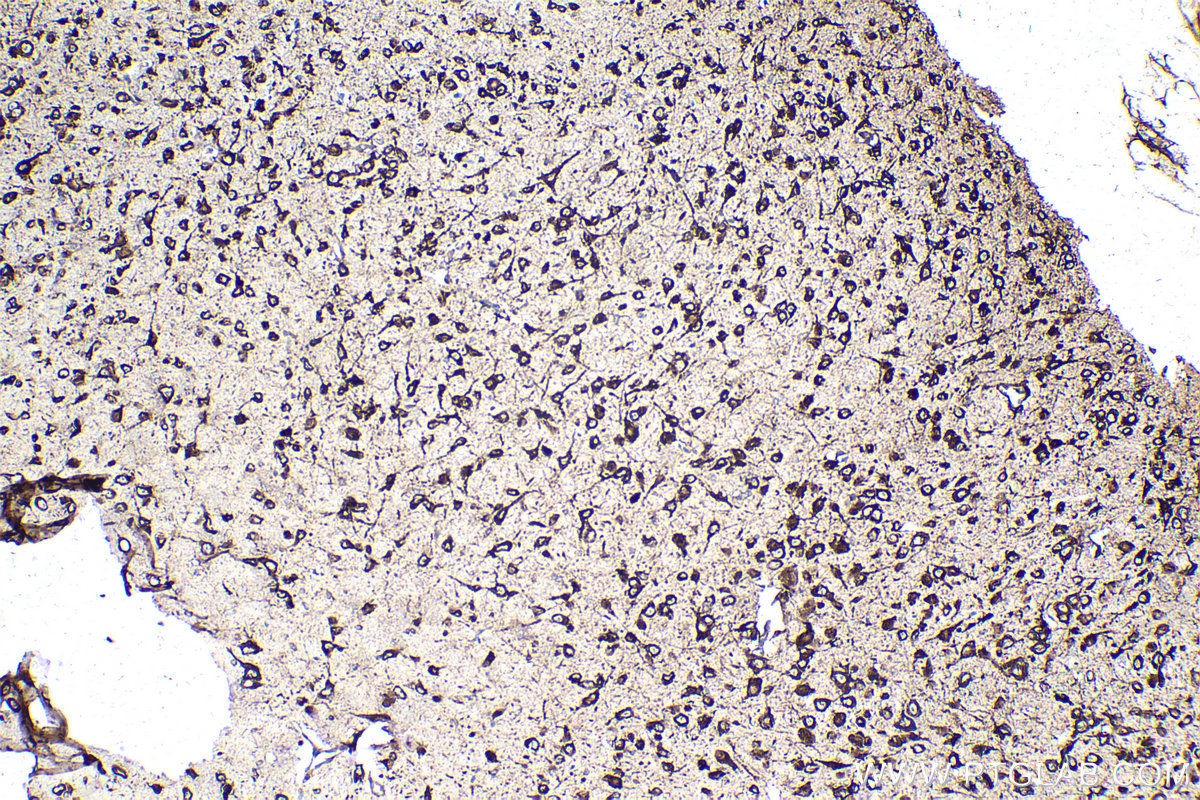 Immunohistochemistry (IHC) staining of mouse brain tissue using PRKRA Monoclonal antibody (68518-1-Ig)