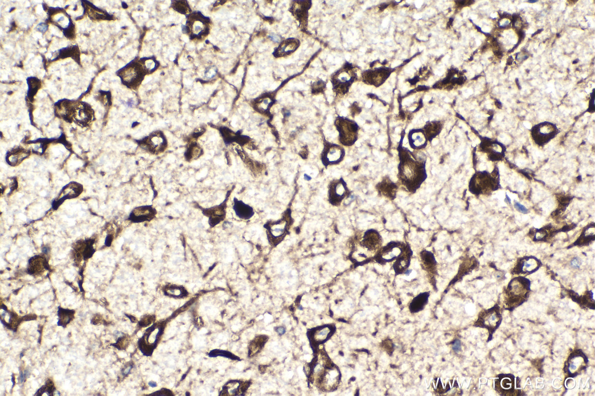 Immunohistochemistry (IHC) staining of mouse brain tissue using PRKRA Monoclonal antibody (68518-1-Ig)